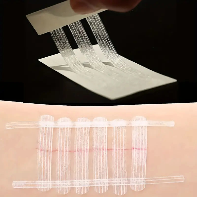 1 Pack, Self-adhesive Tape For Skin Closure, Personal Kit Emergency Supplies, Sterile Low-to-sensitive Non-woven Tape, Skin Adhesive, C-section Suture Tape, Small Wound Closure Kit Cut, 0.61/1.19/2.11 Cm × 10.01 Cm
